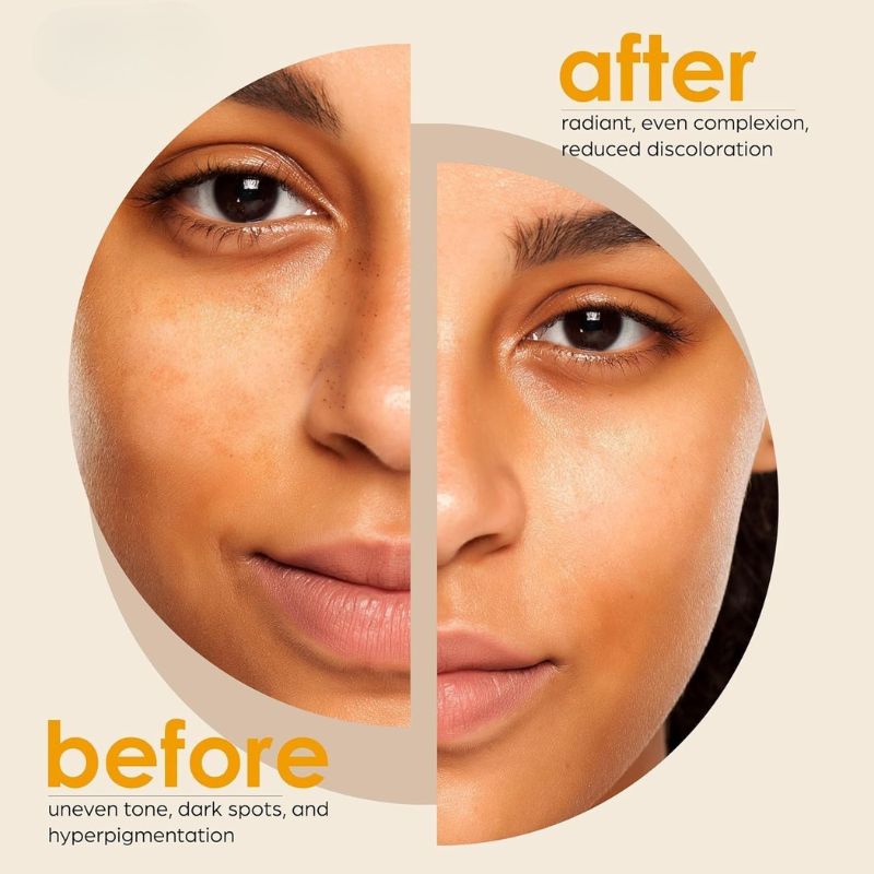 KomalKanti™ by Kiara - Turmeric + Kojic Brightening Bar Soap