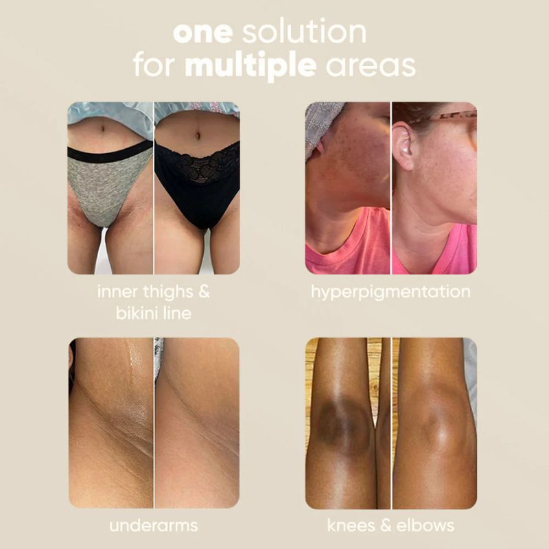 KomalKanti™ by Kiara Turmeric Kojic Brightening Bar Soap